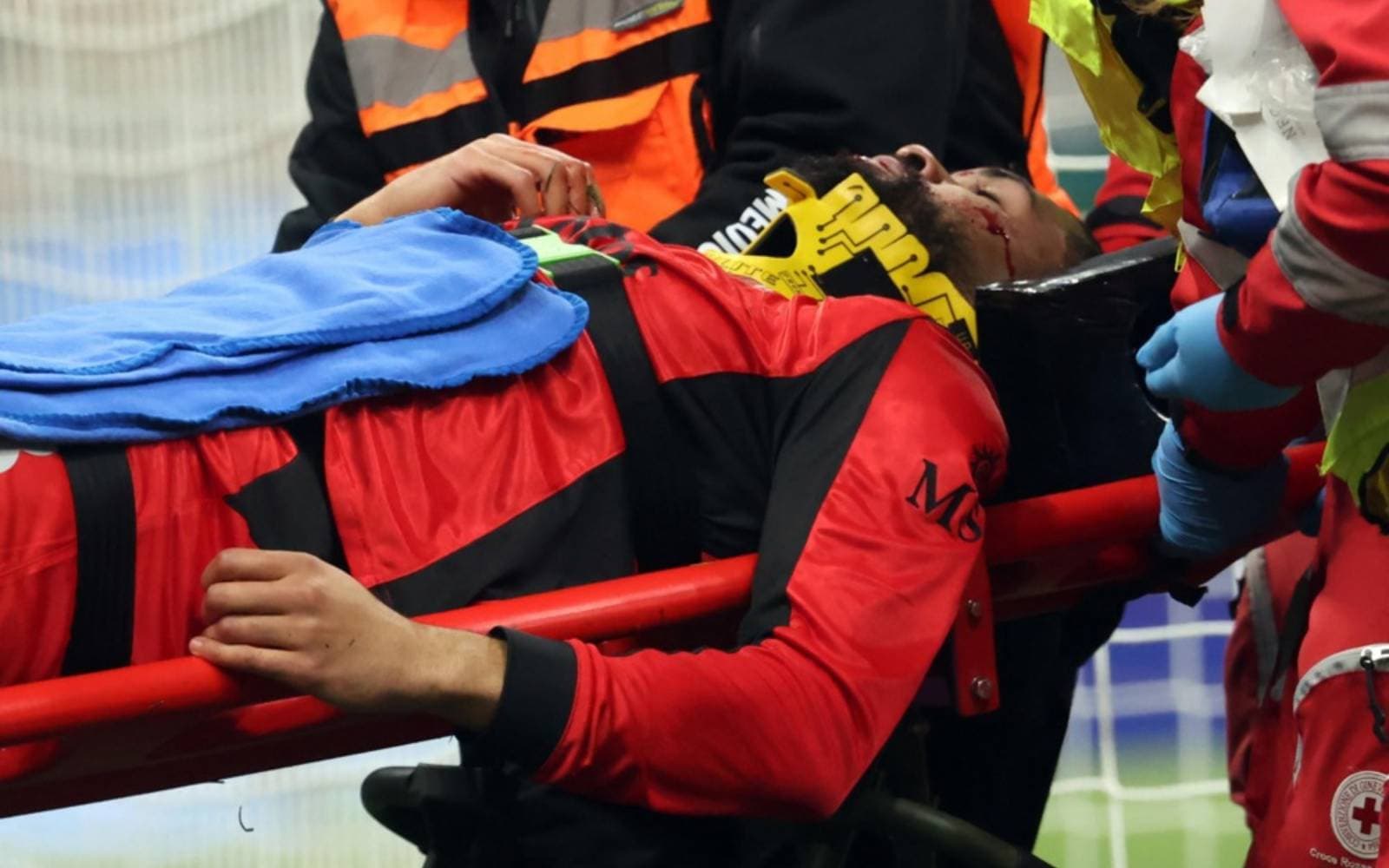 Cover Image for Milan’s Loftus-Cheek out for eight weeks after jaw fracture surgery